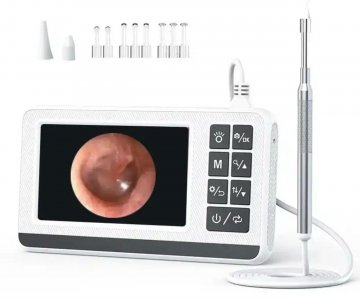 Video Otoskop Cihazı